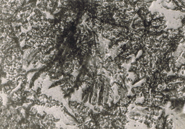 Fig. 12. Photograph of a surface with irregular corrosion